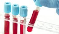 ما هو تحليل lymphocytes – خليجنا نت