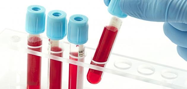 ما هو تحليل lymphocytes – خليجنا نت