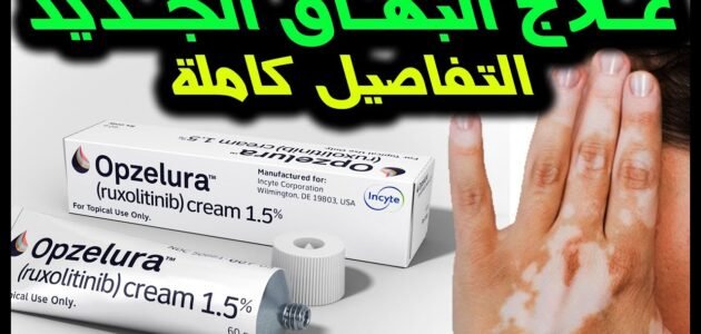 اماكن بيع opzelura كريم في السعودية