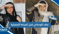 نجلاء الودعاني قبل التجميل
