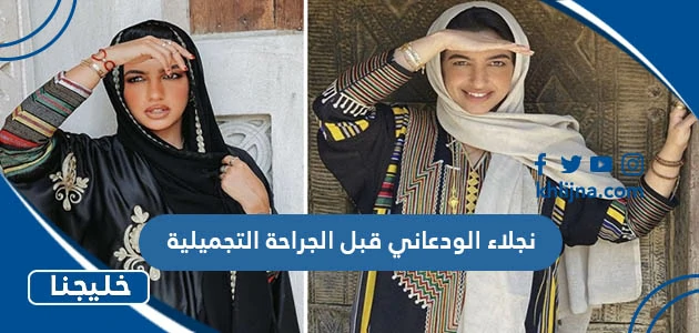 نجلاء الودعاني قبل التجميل