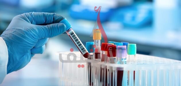 كم مدة بقاء المخدرات في الدم 1 كم مدة بقاء المخدرات في الدم