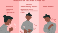 ما المعدل الطبيعي لتحليل crp ويب طب