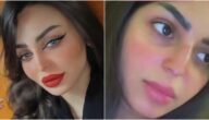 رهف القحطاني قبل وبعد عمليات التجميل