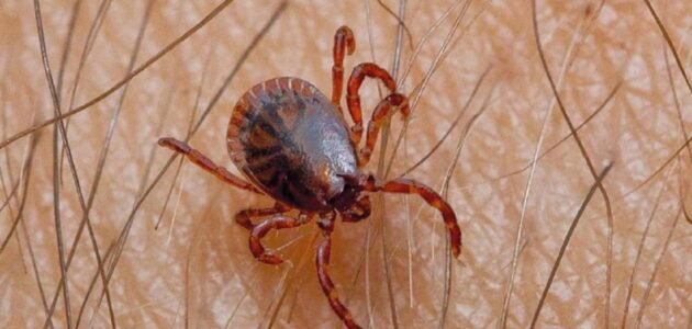 الأولى عالمياً.. وفاة يابانية بفيروس “أوز” من لدغة قرادة