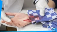 تفسير رؤية الدم في المنام يخرج من شخص آخر
