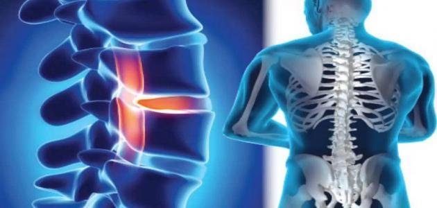 كم فقرة في العمود الفقري