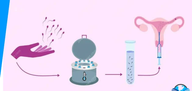 تجربتي مع التلقيح الصناعي بالتفصيل