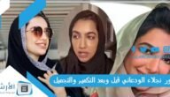 صور نجلاء الودعاني قبل وبعد التكميم والتجميل