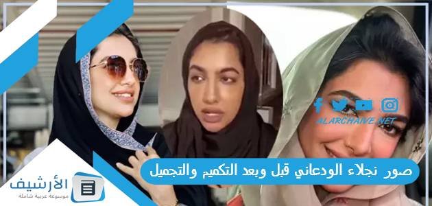 صور نجلاء الودعاني قبل وبعد التكميم والتجميل 1 صور نجلاء الودعاني قبل وبعد التكميم والتجميل