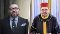 ما هو مرض الملك محمد السادس