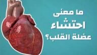 ما هو احتشاء عضلة القلب ويكيبيديا
