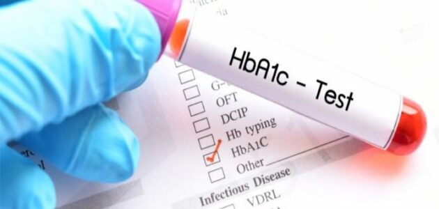 هل تحليل السكر التراكمي يحتاج صيام – خليجنا