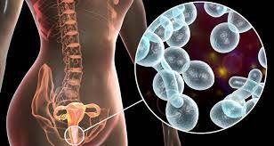 انواع الالتهابات المهبلية بالصور – خليجنا