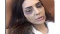 ما هو مرض عبير احمد
