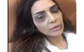 ما هو مرض عبير احمد