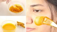وصفات الكركم للتخلص من حب الشباب بكل سهولة وعن تجارب
