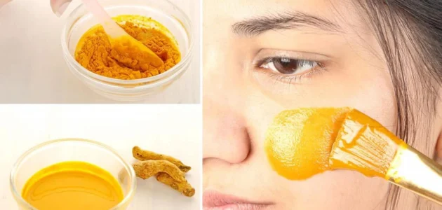 وصفات الكركم للتخلص من حب الشباب بكل سهولة وعن تجارب