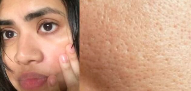 بشرة الأحلام بين إيديك: وصفة منزلية ملكية لتضييق المسام وإشراقة البشرة