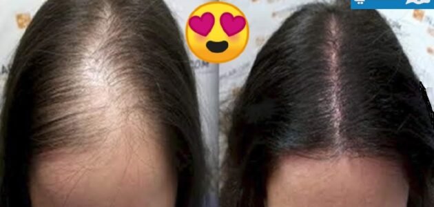 وصفات مضمونة لتقليل تساقط الشعر وتحفيز نموه بشكل سحري 1 وصفات مضمونة لتقليل تساقط الشعر وتحفيز نموه بشكل سحري