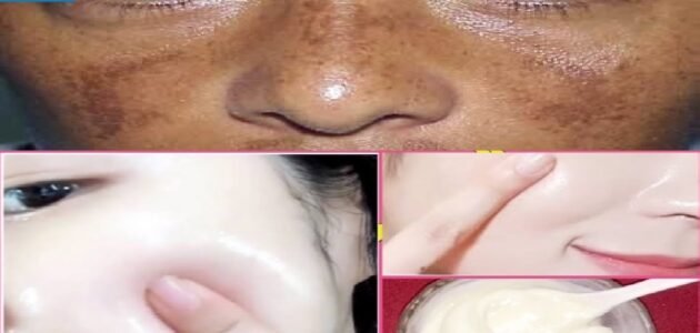 قناع البشرة السحري لتوحيد لون البشرو وتفتيحها يجعلها مشرقة