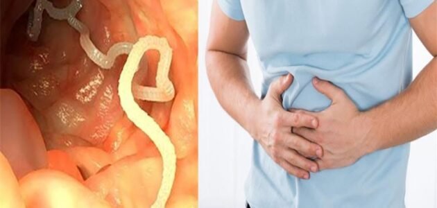 التخلص من ديدان المعدة فى يوم واحد فقط