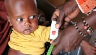 As child malnutrition mounts, UN agencies issue call to action