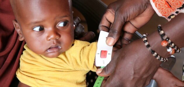 As child malnutrition mounts, UN agencies issue call to action 1 As child malnutrition mounts, UN agencies issue call to action