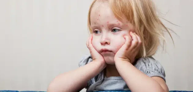 افضل دكتور جلدية أطفال في جدة