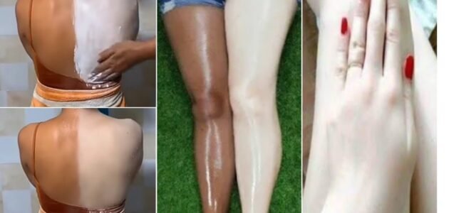 سحر مفعول كريم بانثينول لتفتيح وتبيض الجسم بالكامل وازاله البقع الغامقه 1 سحر مفعول كريم بانثينول لتفتيح وتبيض الجسم بالكامل وازاله البقع الغامقه