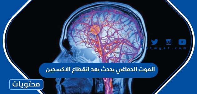 الموت الدماغي يحدث بعد انقطاع الاكسجين