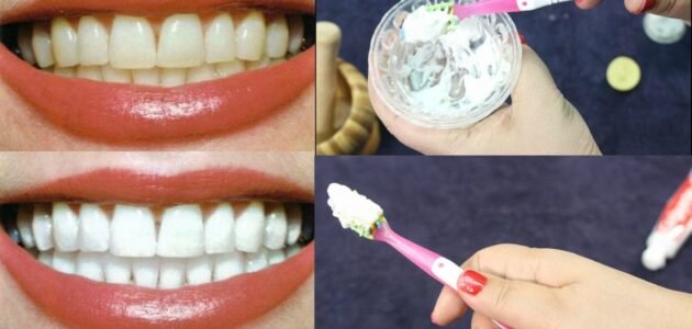 لصفين لولي.. وصفات طبيعية لتبييض الأسنان من الاصفرار والبقع بمكونات بسيطة
