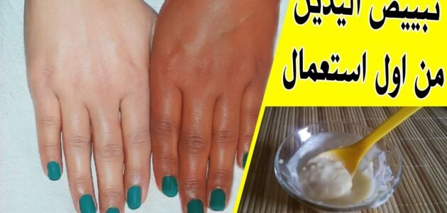 ليدين الهوانم.. وصفة طبيعية لتفتيح اليدين وتبييضهما في المنزل بنتائج مذهلة