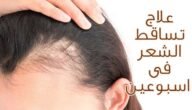 أفضل علاج لتساقط الشعر ومجموعة من الماسكات الطبيعية لمنع التساقط نهائيا