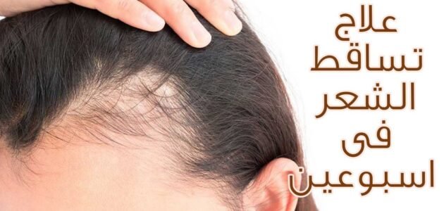 أفضل علاج لتساقط الشعر ومجموعة من الماسكات الطبيعية لمنع التساقط نهائيا