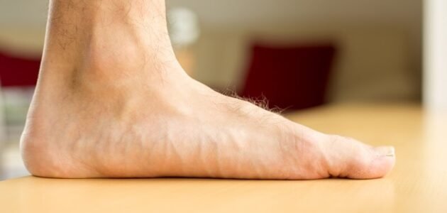 علاج الفلات فوت… أفضل طرق علاج القدم المسطحة