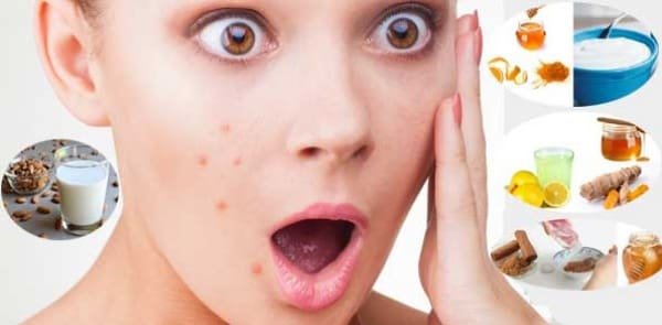 تجربتي مع وصفات لازالة البقع السوداء من الوجه نهائيًا في أسبوع 1 تجربتي مع وصفات لازالة البقع السوداء من الوجه نهائيًا في أسبوع