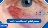 افضل مرهم لعلاج الكدمات حول العين