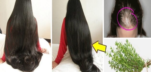 وصفة طبيعية لانبات الشعر في مقدمة الراس وتكثيفه وودع التساقط والفراغات