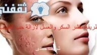 طريقة مقشر السكر والعسل لإزالة حب الشباب 3 طريقة مقشر السكر والعسل لإزالة حب الشباب