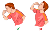 لماذا يجب على المصاب بالرعاف التنفس من الفم لا من الأنف