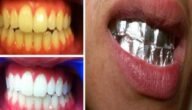 ماذا يحدث عند تغطية أسنانك بورق الألمنيوم لمدة ساعة النتيجة ستبهرك