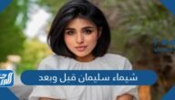 شيماء سليمان قبل وبعد – خليجنا