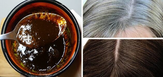 التخلص من الشعر الابيض طبيعيا ووداعًا للشيب المبكر بطرق طبيعية